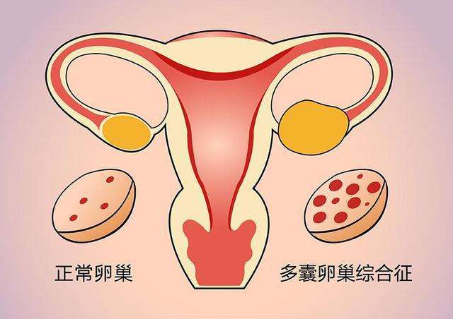 乳腺结节赴泰国试管助孕有关情况