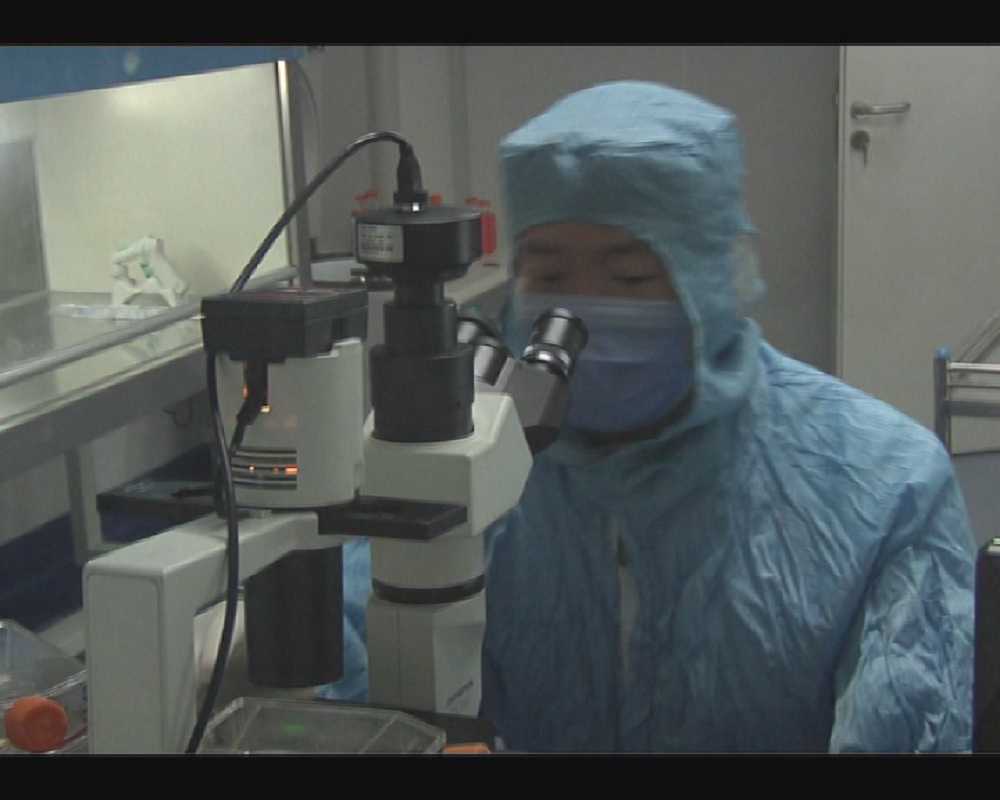 经典医学影像库(133)—肝细胞癌