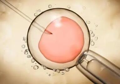 卵巢功能不好可以做试管吗，这些因素都会影响怀孕几率